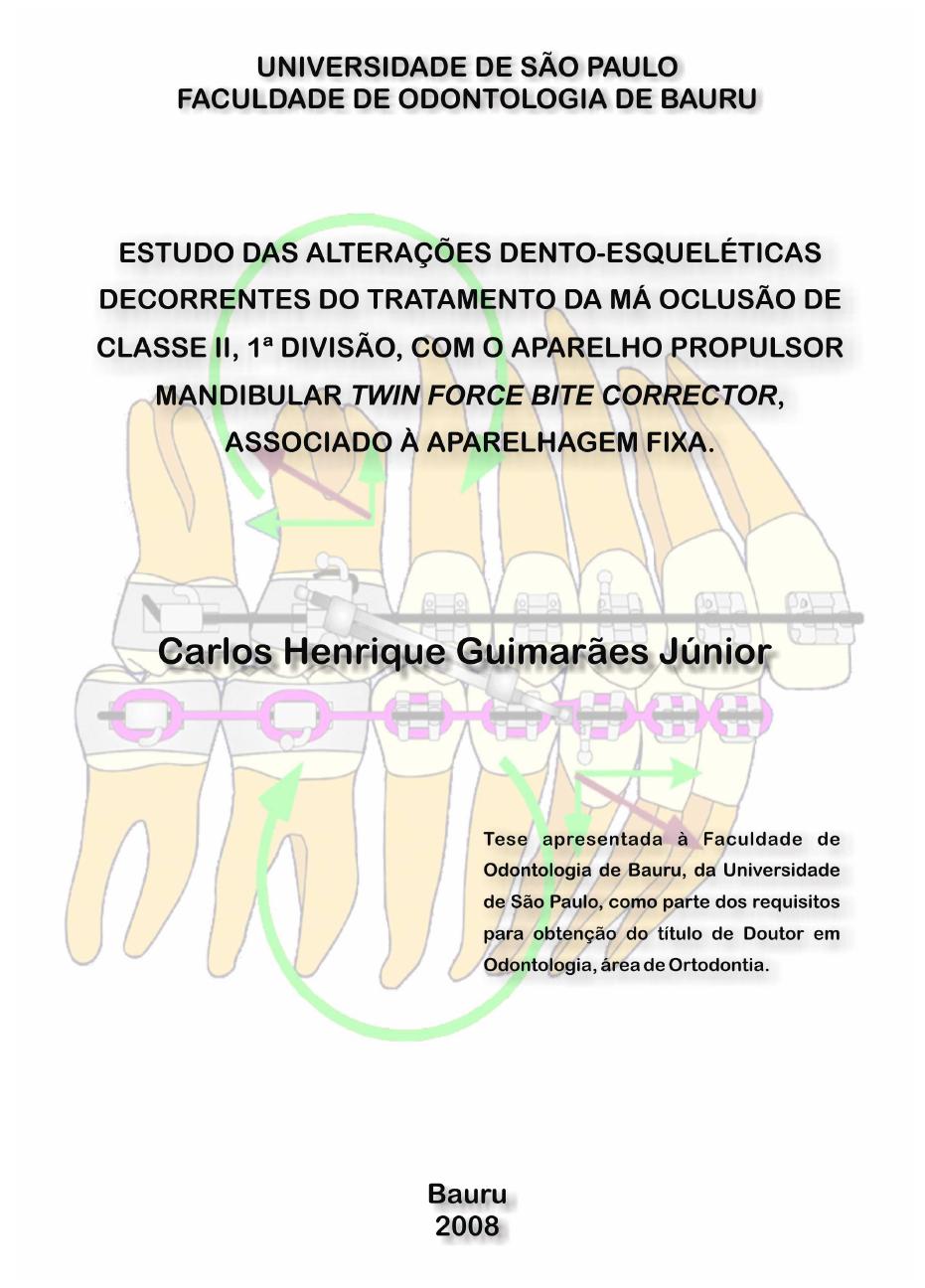 PDF ) Estudo das alterações dento-esqueléticas decorrentes do tratamento da  má oclusão de classe II, 1ª divisão, com o aparelho propulsor mandibular  twin force bite corrector, associado à aparelhagem fixa